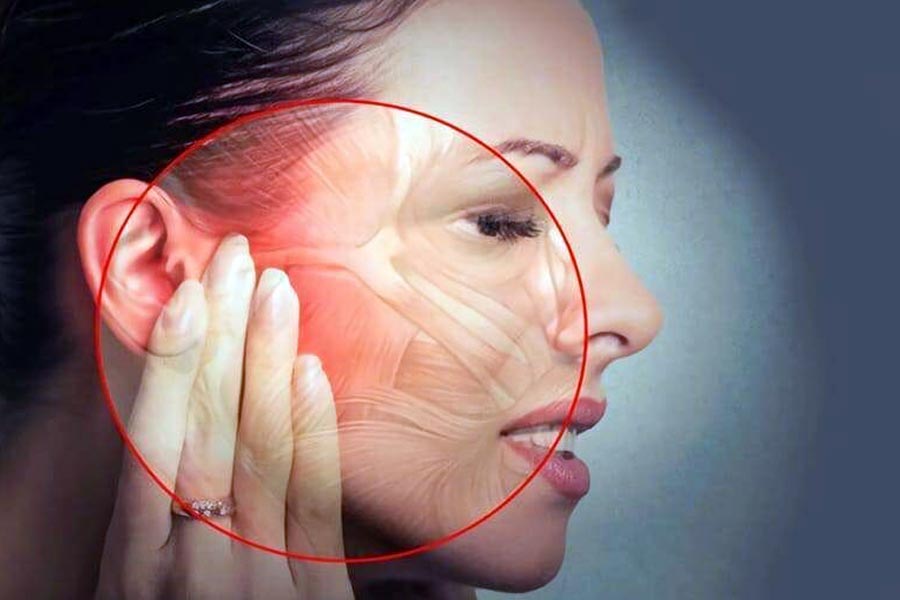 dolor orofacial